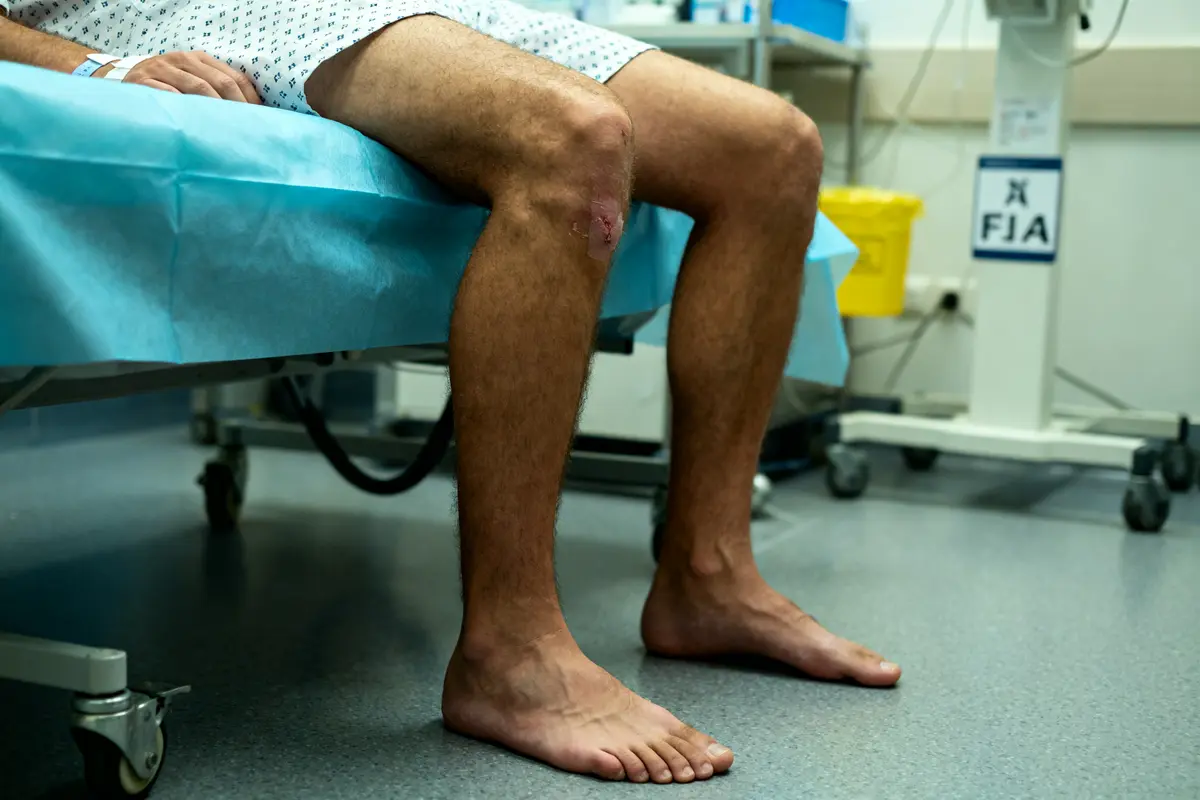 Patient assis sur un lit d'hôpital avec clou gamma pour mouvements interdits au genou